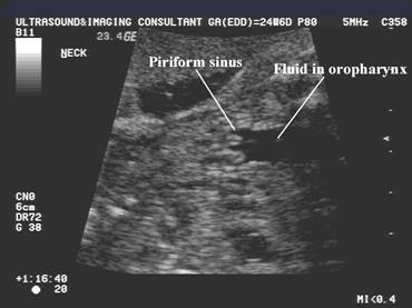 Fetal Larynx and Trachea